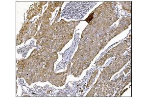 IHC analysis of NDEL1 using anti-NDEL1 antibody (ABIN7602511). (NDEL1 抗体  (AA 80-320))