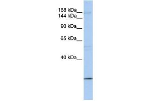WB Suggested Anti-UBR2 Antibody Titration:  0. (UBR2 抗体  (C-Term))