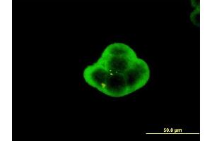 Immunofluorescence of monoclonal antibody to C1orf19 on MCF-7 cell. (TSEN15 抗体  (AA 72-170))