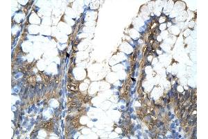PPIA antibody was used for immunohistochemistry at a concentration of 4-8 ug/ml to stain Epithelial cells of intestinal villus (arrows) in Human Intestine. (PPIA 抗体)