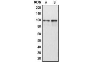 Western blot analysis of DDX54 expression in HeLa (A), Jurkat (B) whole cell lysates. (DDX54 抗体  (Center))