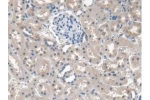 Detection of PINP in Human Kidney Tissue using Monoclonal Antibody to Procollagen I N-Terminal Propeptide (PINP) (PINP 抗体)