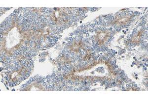 ABIN6275145 at 1/100 staining Human prostate tissue by IHC-P. (GCP6 抗体  (Internal Region))