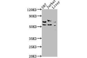 Western Blot Positive WB detected in: U87 whole cell lysate, Jurkat whole cell lysate, Rat liver tissue All lanes: CDK5RAP3 antibody at 1:1000 Secondary Goat polyclonal to rabbit IgG at 1/50000 dilution Predicted band size: 57, 47, 32, 60 kDa Observed band size: 57 kDa (CDK5RAP3 抗体  (Regulatory Subunit))