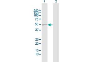 Western Blot analysis of DBC1 expression in transfected 293T cell line by DBC1 MaxPab polyclonal antibody. (DBC1 抗体  (AA 1-320))