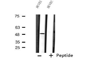 Western blot analysis of extracts from HUVEC cells using FOXD3 antibody. (FOXD3 抗体  (Internal Region))