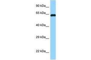 Image no. 1 for anti-Abl-Interactor 1 (ABI1) (AA 122-171) antibody (ABIN6748110) (ABI1 抗体  (AA 122-171))