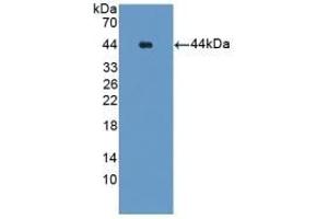 Detection of Recombinant Glutamine Synthetase, Human using Polyclonal Antibody to Glutamine synthetase (GS) (GLN1 抗体  (AA 1-373))