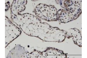 Image no. 1 for anti-MYST Histone Acetyltransferase (Monocytic Leukemia) 3 (MYST3) (AA 81-180) antibody (ABIN599471) (MYST3 抗体  (AA 81-180))