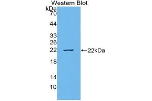 Detection of Recombinant VEGI, Rat using Polyclonal Antibody to TNF Like Ligand 1A (TL1A) (TNF Like Ligand 1A (AA 70-230) 抗体)