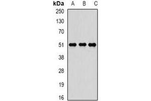 Western blot analysis of Reptin 52 expression in K562 (A), SW480 (B), MCF7 (C) whole cell lysates. (RUVBL2 抗体)