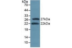 Detection of Recombinant ATF4, Mouse using Polyclonal Antibody to Activating Transcription Factor 4 (ATF4) (ATF4 抗体  (AA 126-291))