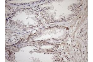 Immunohistochemistry (IHC) image for anti-Achalasia, Adrenocortical Insufficiency, Alacrimia (AAAS) (AA 322-546) antibody (ABIN2715861) (Adracalin 抗体  (AA 322-546))