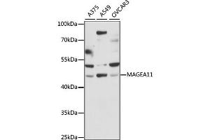 Western blot analysis of extracts of various cell lines, using MAGEA11 antibody (ABIN6290619) at 1:1000 dilution. (MAGEA11 抗体)