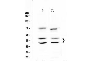 Western blot analysis of CaMKII alpha using anti-CaMKII alpha antibody . (CAMK2A 抗体  (AA 392-457))