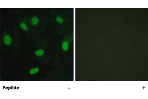 Immunofluorescence analysis of HeLa cells, using TBX15/TBX18 polyclonal antibody . (T-Box 15 抗体)