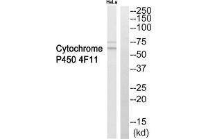 Western blot analysis of extracts from HeLa cells, using Cytochrome P450 4F11 antibody. (CYP4F11 抗体  (Internal Region))
