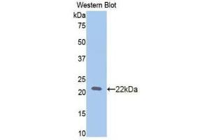 Western Blotting (WB) image for anti-Slit Homolog 2 (Drosophila) (SLIT2) (AA 209-374) antibody (ABIN1173404) (SLIT2 抗体  (AA 209-374))