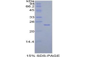 SDS-PAGE analysis of Rat TIMP4 Protein. (TIMP4 蛋白)