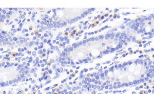 Immunohistochemistry (IHC) image for anti-Cytotoxic T-Lymphocyte-Associated Protein 4 (CTLA4) (AA 52-211) antibody (ABIN7426229)