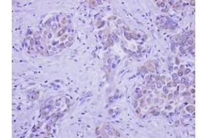 Image no. 1 for anti-UDP-N-Acetyl-alpha-D-Galactosamine:polypeptide N-Acetylgalactosaminyltransferase 2 (GalNAc-T2) (GALNT2) (AA 272-523) antibody (ABIN1498370) (GALNT2 抗体  (AA 272-523))