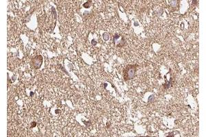ABIN6267615 at 1/100 staining human brain tissue sections by IHC-P. (GRIN1/NMDAR1 抗体  (pSer890))