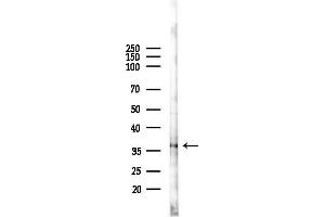 Western blot analysis of lysates from F10-LUC cells(heat-shock 45 min treatment), using PPP2CB Antibody at 1/1000 dilution.