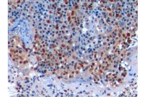 Immunohistochemistry (IHC) image for anti-Proliferating Cell Nuclear Antigen (PCNA) (AA 6-261) antibody (ABIN7443113)