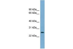 WB Suggested Anti-LIN37 Antibody Titration: 0. (LIN37 抗体  (Middle Region))
