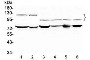 Western blot testing of 1) rat testis, 2) mouse testis, 3) human HeLa, 4) human A549 and 6) human SK-OV-3 lysate with NFATC4 antibody at 0.