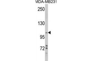 Western Blotting (WB) image for anti-Phosphoinositide-3-Kinase, Class 3 (PIK3C3) antibody (ABIN3000299) (PIK3C3 抗体)