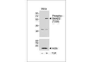 Western blot analysis of lysates from Hela cell line, untreated or treated with TGF-β, 100 ng/mL, 30 min, using Phospho-SD2 Antibody (ABIN650816 and ABIN2839794) (upper) or Beta-actin (lower). (SMAD2 抗体  (pThr220))