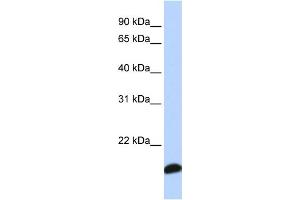 WB Suggested Anti-PRDX5 Antibody Titration: 0. (Peroxiredoxin 5 抗体  (Middle Region))