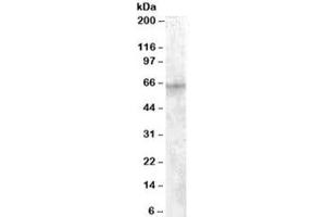 Western blot testing of HepG2 cell lysate with IGF2BP2 antibody at 1ug/ml. (IGF2BP2 抗体)