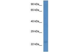 Image no. 1 for anti-Membrane-Associated Ring Finger (C3HC4) 3, E3 Ubiquitin Protein Ligase (MARCH3) (AA 128-177) antibody (ABIN6746215)