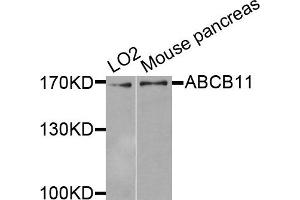 Western blot analysis of extracts of various cells, using ABCB11 antibody. (ABCB11 抗体)