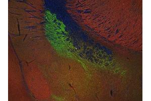 Indirect immunostaining of PFA fixed mouse brain section with anti-SV 2C (dilution 1 : 200; green) and rabbit anti-endophilin (ABIN1742336, dilution 1 : 200; red). (SV2C 抗体  (AA 2-16))
