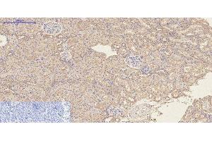 Immunohistochemistry of paraffin-embedded Rat kidney tissue using CD23 Monoclonal Antibody at dilution of 1:200.