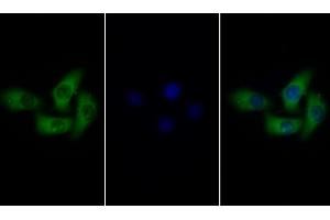 Detection of gp130 in Human Hela cell using Polyclonal Antibody to Glycoprotein 130 (gp130) (CD130/gp130 抗体  (AA 238-500))