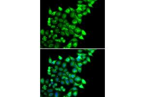 Immunofluorescence analysis of U2OS cells using MEST antibody (ABIN6133292, ABIN6143749, ABIN6143751 and ABIN6222673). (MEST 抗体  (AA 146-335))