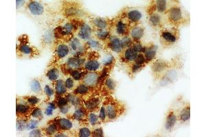 Immunohistochemistry (IHC) image for anti-serpin Peptidase Inhibitor, Clade A (Alpha-1 Antiproteinase, Antitrypsin), Member 6 (SERPINA6) (AA 102-120), (N-Term) antibody (ABIN3042818)