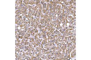 IHC analysis of STAP2 using anti-STAP2 antibody (ABIN7602686). (STAP2 抗体  (AA 95-392))