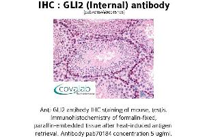 Image no. 1 for anti-GLI Family Zinc Finger 2 (GLI2) (Internal Region) antibody (ABIN1734718) (GLI2 抗体  (Internal Region))
