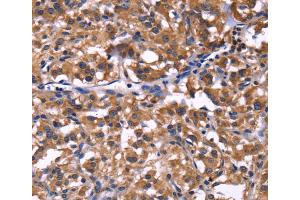 Immunohistochemistry (IHC) image for anti-Selectin P Ligand (SELPLG) antibody (ABIN2422074) (SELPLG 抗体)