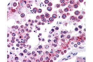 Immunohistochemistry (IHC) image for anti-Wingless-Type MMTV Integration Site Family, Member 5B (WNT5B) (Middle Region) antibody (ABIN2776725) (WNT5B 抗体  (Middle Region))