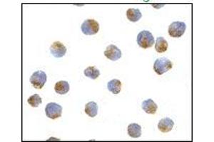 AP20056PU-N ATG7 antibody staining of L1210 cells by Immunocytochemistry at 10 μg/ml. (ATG7 抗体  (N-Term))
