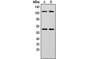 Western blot analysis of NF-kappaB p105/p50 (pS337) expression in HeLa (A), MCF7 (B) whole cell lysates. (NFKB1 抗体  (pSer337))