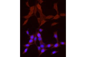 Immunofluorescence analysis of NIH/3T3 cells using BMP4 Rabbit pAb (ABIN6127497, ABIN6137600, ABIN6137603 and ABIN6215157) at dilution of 1:50 (40x lens).