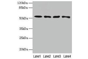 Western blot All lanes: CAP2 antibody at 4 μg/mL Lane 1: HepG2 whole cell lysate Lane 2: Mouse muscle tissue Lane 3: Mouse gonadal tissue Lane 4: Hela whole cell lysate Secondary Goat polyclonal to rabbit IgG at 1/10000 dilution Predicted band size: 53, 46, 25 kDa Observed band size: 53 kDa (CAP2 抗体  (AA 221-477))