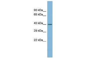 WB Suggested Anti-ZCCHC12 Antibody Titration: 0. (ZCCHC12 抗体  (Middle Region))
